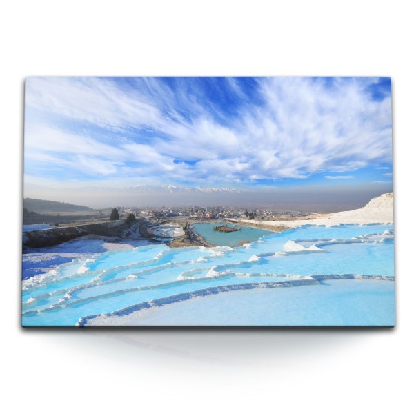 Paul Sinus Art 120x80cm Wandbild auf Leinwand Pamukkale Türkei Thermalwasser Hellblau Natur