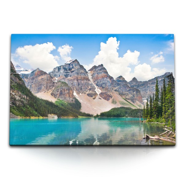 Paul Sinus Art 120x80cm Wandbild auf Leinwand Rocky Mountains USA Berge Bergsee Natur